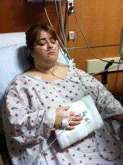 Day of Surgeru March 13, 2013  An hr after RNY...