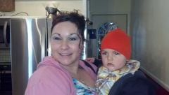 Another before surgery pic