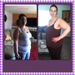 2 mos post op
