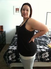 2 mos post-op
