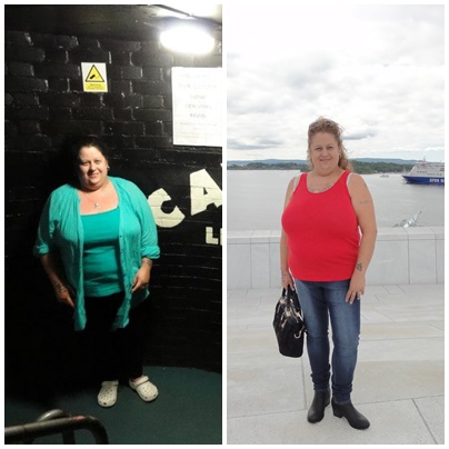 before aand 10 weeks post op 