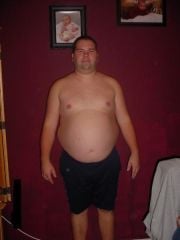 night before surgery 310 lbs