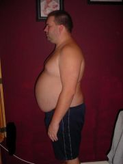 310 lbs night before surgery