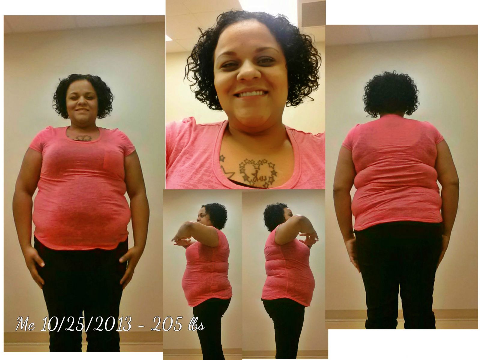 2 Weeks Before Pre Op Diet