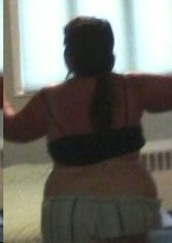 2 weeks Pre-op