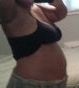 2 weeks Pre-Op