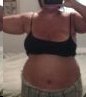 2 weeks pre-op