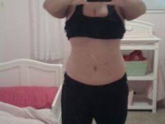 13 weeks post op
