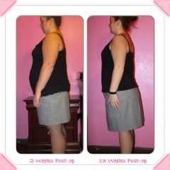 Before and After