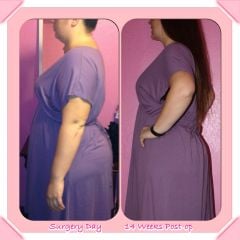 14 Weeks Post-Op Side