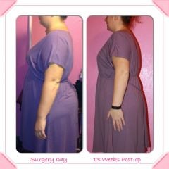 Before and After