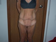 Pre (2)