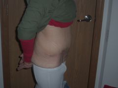 5 Wks post (3)