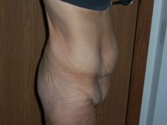 Pre (3)