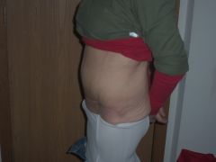 5 Wks post