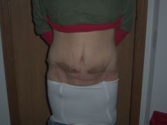 5 Wks post (2)