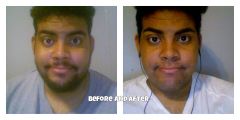 before and after