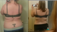 BackBeforeAfter6wks