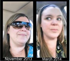 4 1/2 Months Post VSG