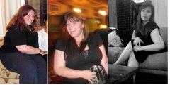 on left, before 280ish; in middle, at surgery time, 250ish; on right, 180