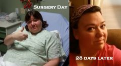 28 day comparison