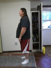 the day beore surgery