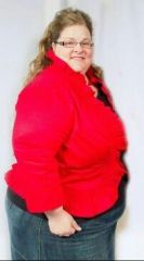BEFORE pic taken 3 days prior to surgery Feb. 11, 2012