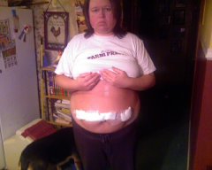 just home from surgery
