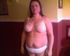 1 week after surgery