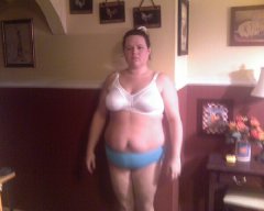 2 weeks after surgery. 20lbs lost!