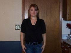 1 year post-op