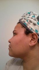 BEFORE - side face - 258 lbs