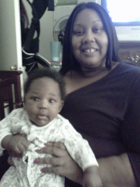 Before Surgery