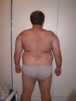 I had high blood pressure, sleep apnea and high cholesterol