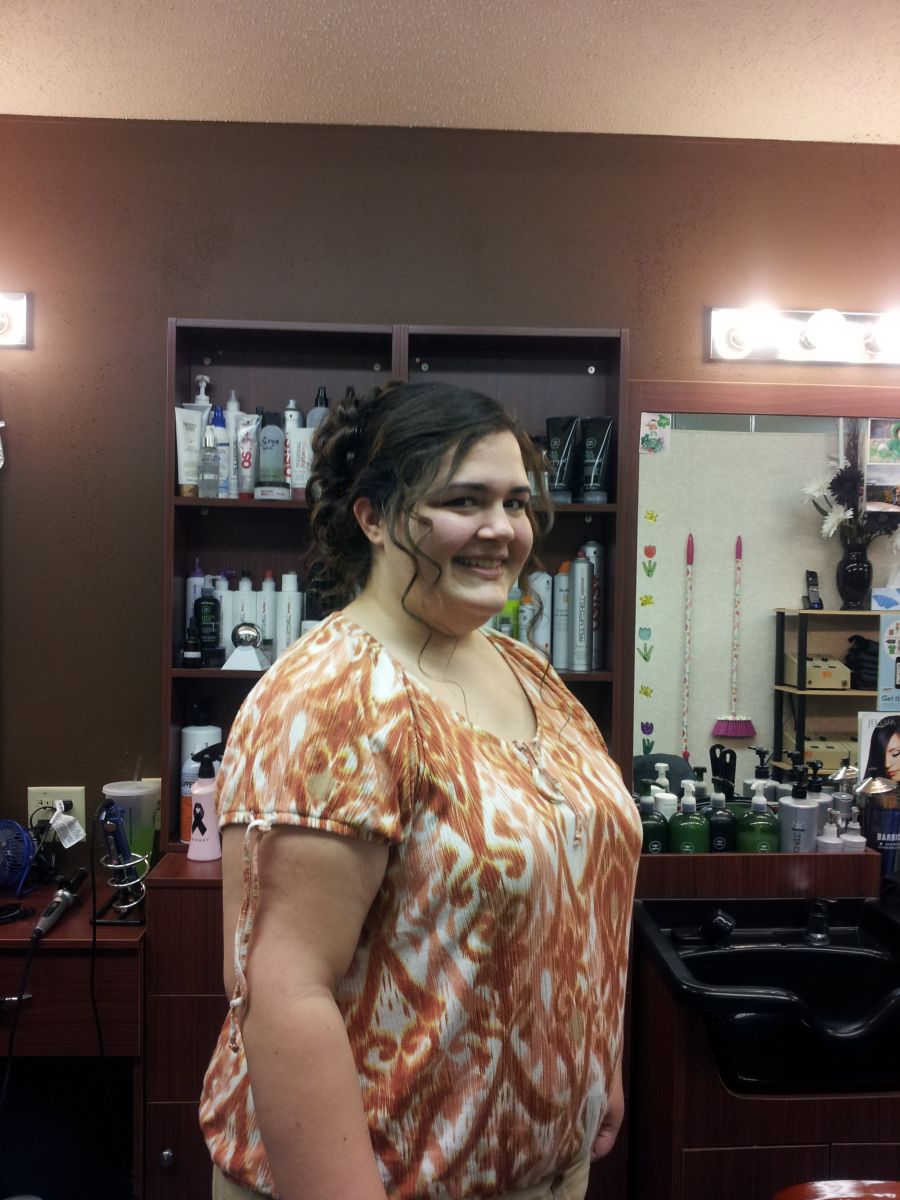 Preop photos