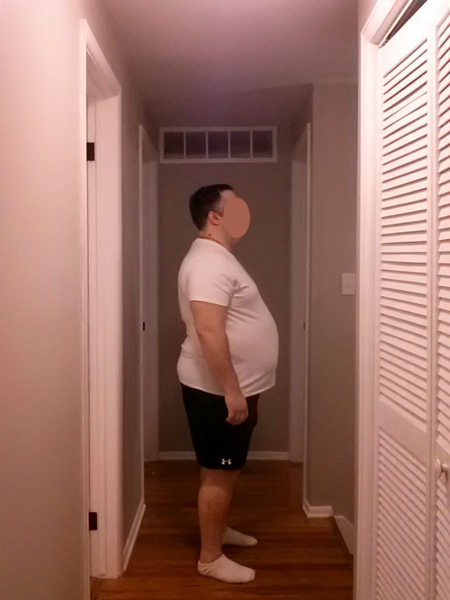 Before Pics 12-26-13