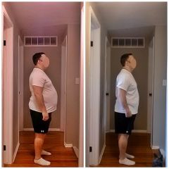 Before & After Right 02-26-14