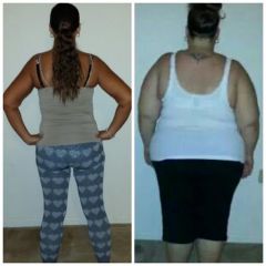 1 yearpost op