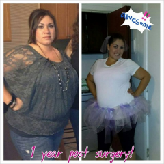 Before and After