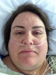 0327 Surgery Day