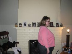 Side view. Day before surgery -3/29/09