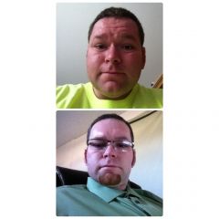 Before surgery and current