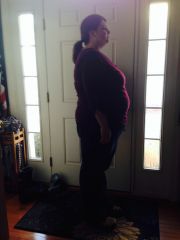 Shortly after surgery