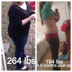 4.5 months post-op (-70 lbs); disregard the messy room