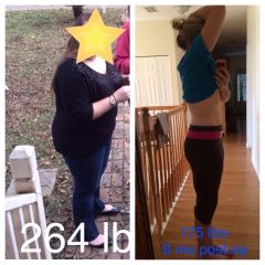 8 months post-op; about 90 lbs down