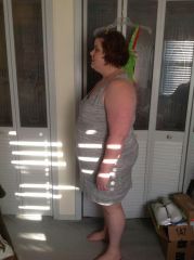 Day 2 post op