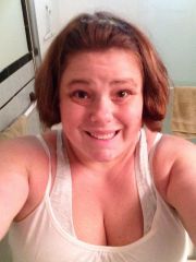 Day 3 post op, feeling better!
