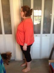 Side view pre op