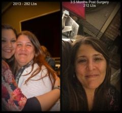 Sleeve - Face - Before & after - 3 months.jpg