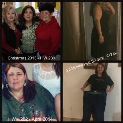 Sleeve - Before & After - 3 months.jpg